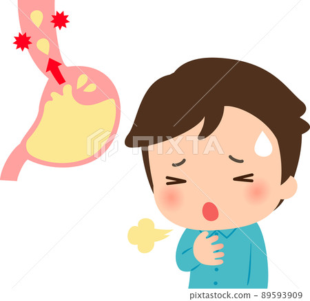 A young man suffering from the symptoms of reflux esophagitis 89593909