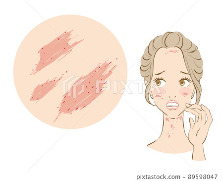 一個患有過敏和敏感皮膚的可愛女人 一個患有過敏和敏感皮膚的可愛女人 89598047