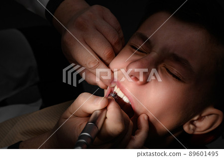 Visiting a dentist, brushing a tooth with a drill, a schoolboy at a pediatric dentist. Visiting a dentist, brushing a tooth with a drill, a schoolboy at a pediatric dentist. 89601495