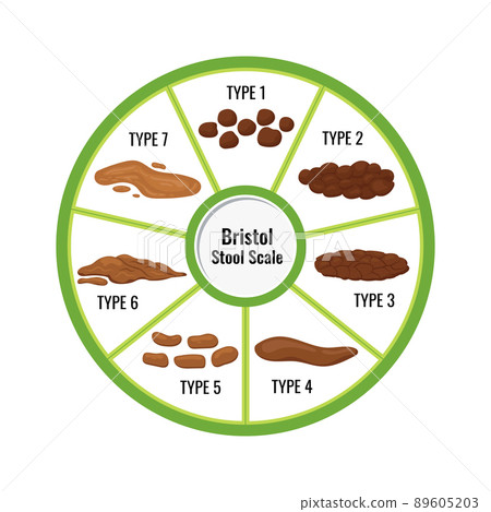 Bristol stool chart with faesces classification vector illustration. 89605203