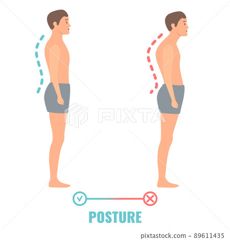 Good and bad posture comparison medical illustration 89611435