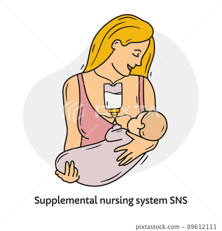 A woman breast-feeds a baby with supplemental nursing system SNS 89612111