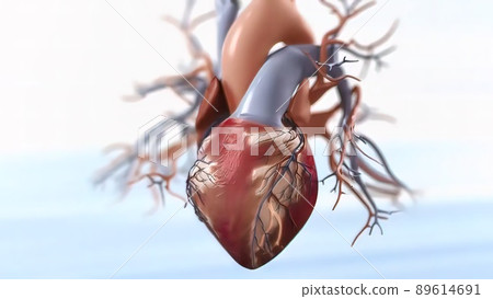 Acute Coronary Syndrome 3d medical Acute Coronary Syndrome 3d medical 89614691