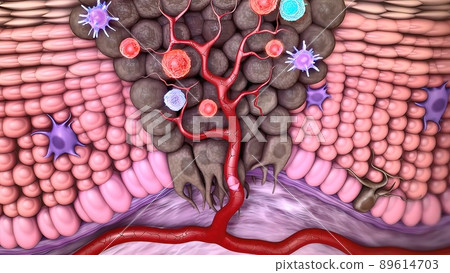 Cytosine T cell clears tumor cells Cytosine T cell clears tumor cells 89614703