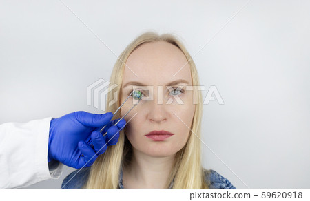 Conceptual shot of an eye crystalline lens replacement. Ophthalmic surgery. Return of sight. Removal of cataracts. Surgical intervention in the eyeball. Doctor holds the implant near the patient Conceptual shot of an eye crystalline lens replacement. Ophthalmic surgery. Return of sight. Removal of cataracts. Surgical intervention in the eyeball. Doctor holds the implant near the patient 89620918