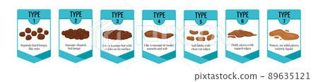 Bristol stool chart with faesces type classification. 89635121