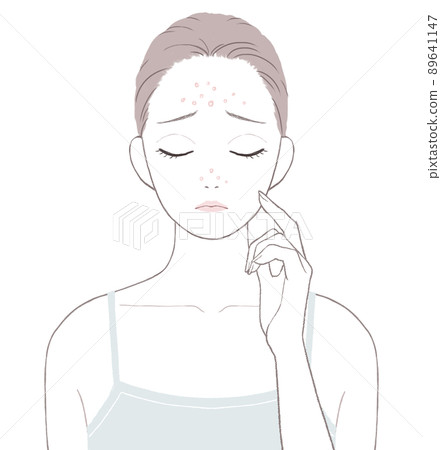 A woman suffering from acne in the T zone A woman suffering from acne in the T zone 89641147