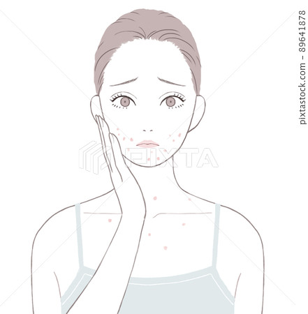 Women suffering from adult acne Women suffering from adult acne 89641878