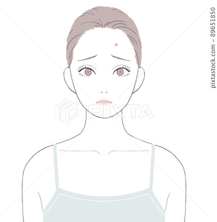 Women suffering from acne pimples 89651850