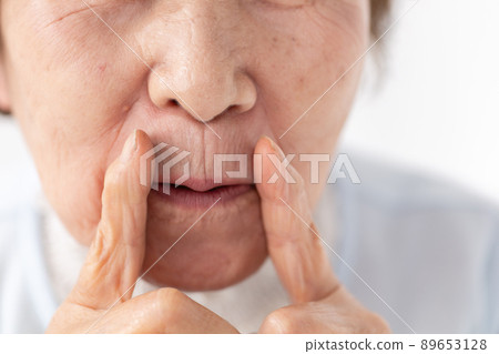 高級美容嘴法令紋 89653128