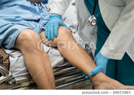 Asian senior or elderly old lady woman patient show her scars surgical total knee joint replacement Suture wound surgery arthroplasty on bed in nursing hospital ward, healthy strong medical concept. 89653965