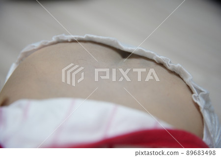 baby buttocks 89683498