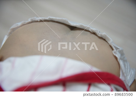 baby buttocks 89683500