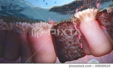Bacteria attack the digestive system Bacteria attack the digestive system 89690020