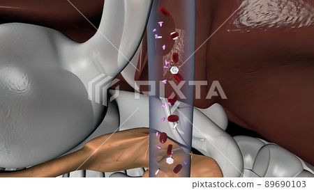 Diabetes is a metabolic disorder caused by high levels of blood sugar. 89690103