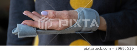 Orthopedic brace on an injured female finger 89693539
