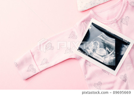 Ultrasound image pregnant baby photo. Fashion cute baby cloth with ultrasound pregnancy picture on pink background. Concept maternity, pregnancy, childbirth. 89695669