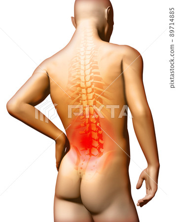 Lumbar pain 89714885