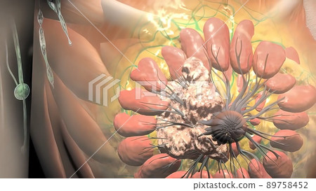 Breast Cancer, Breast anatomy, Growing tumor. Cancer that forms in the cells of the breasts. 89758452