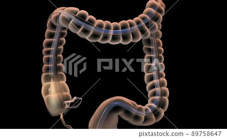 The Human Digestive System. 3D illustration of the colonoscopy Procedure The Human Digestive System. 3D illustration of the colonoscopy Procedure 89758647