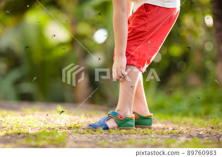 Mosquito on kids skin. Insect bite repellent. 89760983