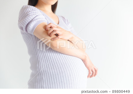 Pregnant woman scratching her upper arm Pregnant pruritus 89800449
