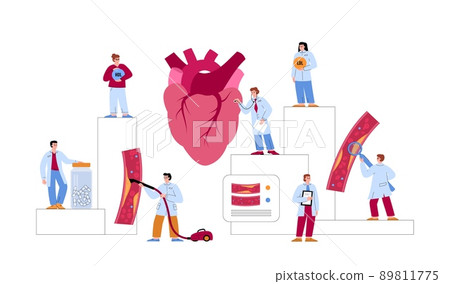 Doctors examining and treating clogged with cholesterol arteries, flat vector illustration on white background. Doctors examining and treating clogged with cholesterol arteries, flat vector illustration on white background. 89811775
