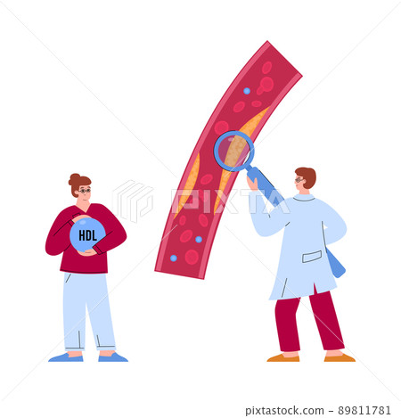 Doctor looking at cholesterol in artery with magnifying glass, flat vector illustration isolated on white background. Doctor looking at cholesterol in artery with magnifying glass, flat vector illustration isolated on white background. 89811781