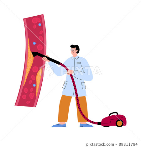 Cardiologist or surgeon cleaning clogged artery from cholesterol with vacuum cleaner. Cardiologist or surgeon cleaning clogged artery from cholesterol with vacuum cleaner. 89811784
