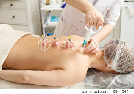 Vacuum massage. Vacuum cups of medical cupping therapy on woman back, close up, chinese medicine. 89840444