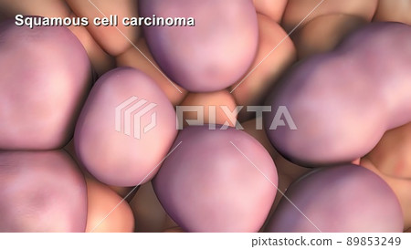 Division and growth of cancerous cells Division and growth of cancerous cells 89853249