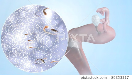Female reproductive organ, sperm entering the canal Female reproductive organ, sperm entering the canal 89853317