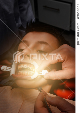 Close up of installing braces on teeth, aligning teeth with braces, retractor on lips. Close up of installing braces on teeth, aligning teeth with braces, retractor on lips. 89858667