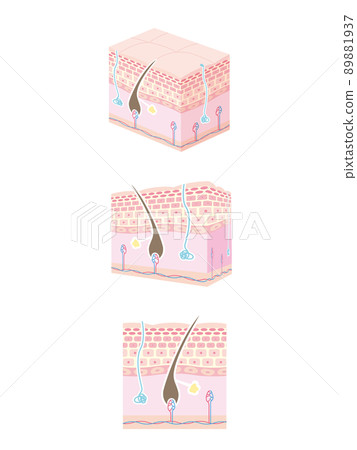 皮膚剖面圖 89881937