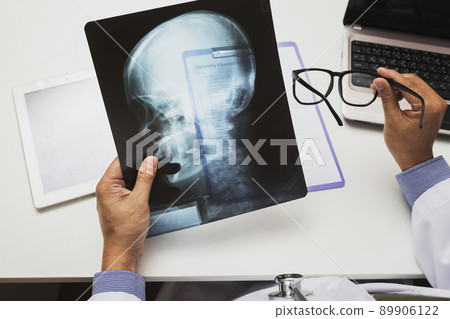 Medicine and health care concept. Doctor diagnose and analyze on x-ray film of patient. 89906122