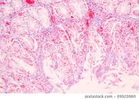 Tissue of Stomach Human under the microscope in Lab. 89920860