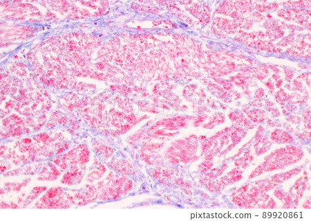 Tissue of Stomach Human under the microscope in Lab. 89920861