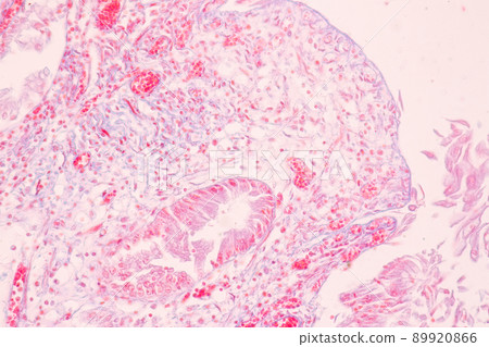 Tissue of Stomach Human under the microscope in Lab. 89920866