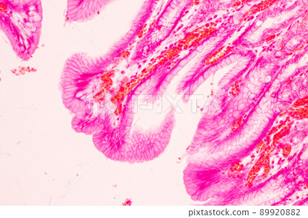 Tissue of Stomach Human under the microscope in Lab. 89920882