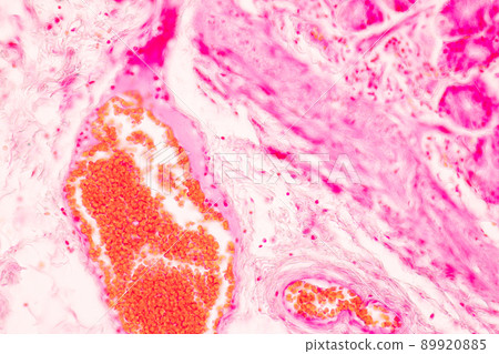 Tissue of Stomach Human under the microscope in Lab. 89920885