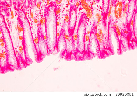 Tissue of Stomach Human under the microscope in Lab. Tissue of Stomach Human under the microscope in Lab. 89920891