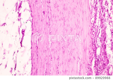 Tissue of Small intestine (Duodenum) and Vermiform appendix  Human under the microscope in Lab. 89920988