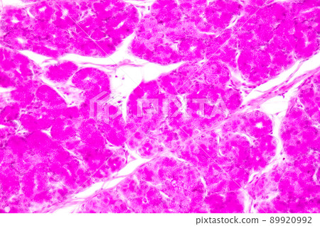 Tissue of Small intestine (Duodenum) and Vermiform appendix  Human under the microscope in Lab. 89920992