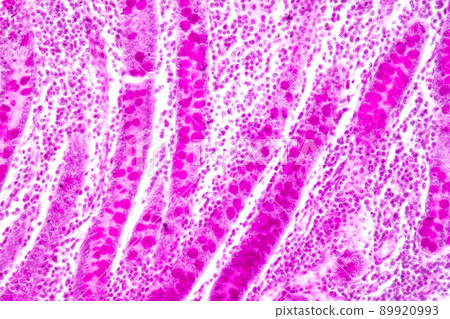 Tissue of Small intestine (Duodenum) and Vermiform appendix Human under the microscope in Lab. Tissue of Small intestine (Duodenum) and Vermiform appendix Human under the microscope in Lab. 89920993