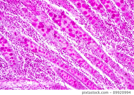 Tissue of Small intestine (Duodenum) and Vermiform appendix  Human under the microscope in Lab. 89920994