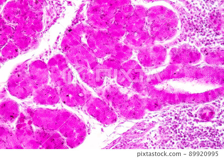 Tissue of Small intestine (Duodenum) and Vermiform appendix  Human under the microscope in Lab. 89920995