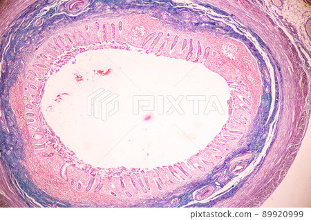 Tissue of Small intestine (Duodenum) and Vermiform appendix Human under the microscope in Lab. Tissue of Small intestine (Duodenum) and Vermiform appendix Human under the microscope in Lab. 89920999