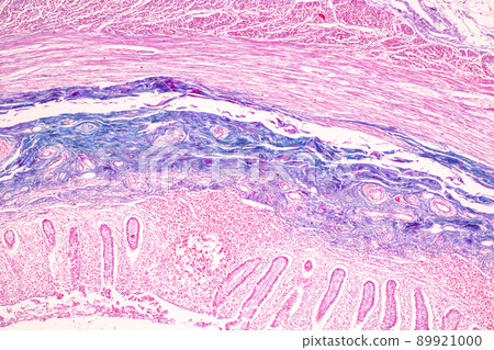 Tissue of Small intestine (Duodenum) and Vermiform appendix Human under the microscope in Lab. Tissue of Small intestine (Duodenum) and Vermiform appendix Human under the microscope in Lab. 89921000