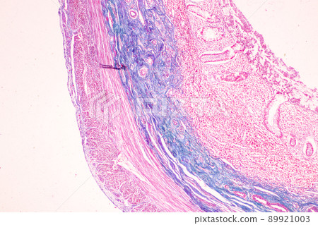 Tissue of Small intestine (Duodenum) and Vermiform appendix Human under the microscope in Lab. Tissue of Small intestine (Duodenum) and Vermiform appendix Human under the microscope in Lab. 89921003