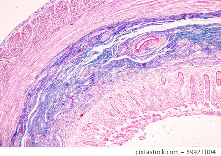 Tissue of Small intestine (Duodenum) and Vermiform appendix  Human under the microscope in Lab. 89921004
